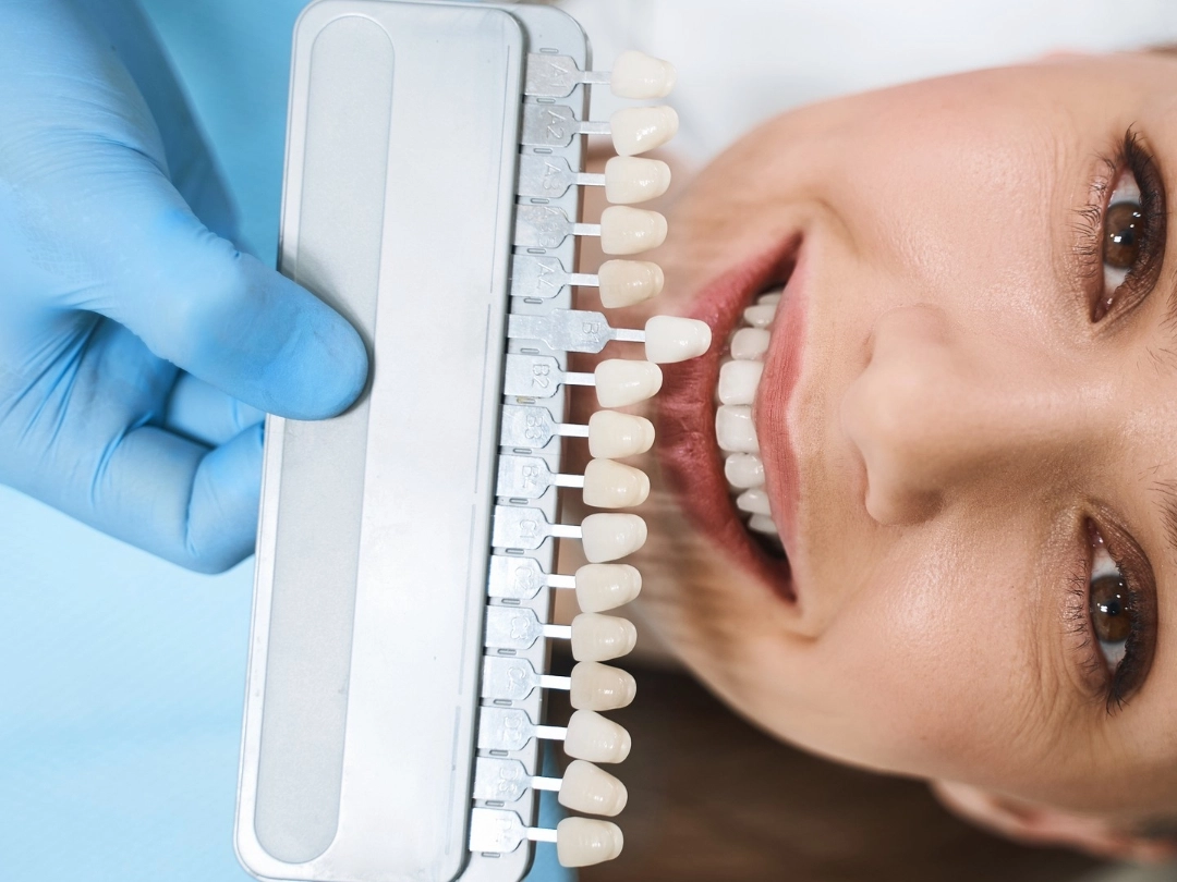 Private Dental Care